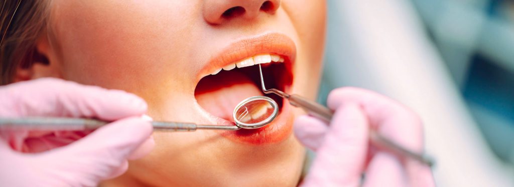 Zahnarzt Weinstock - Behandlung